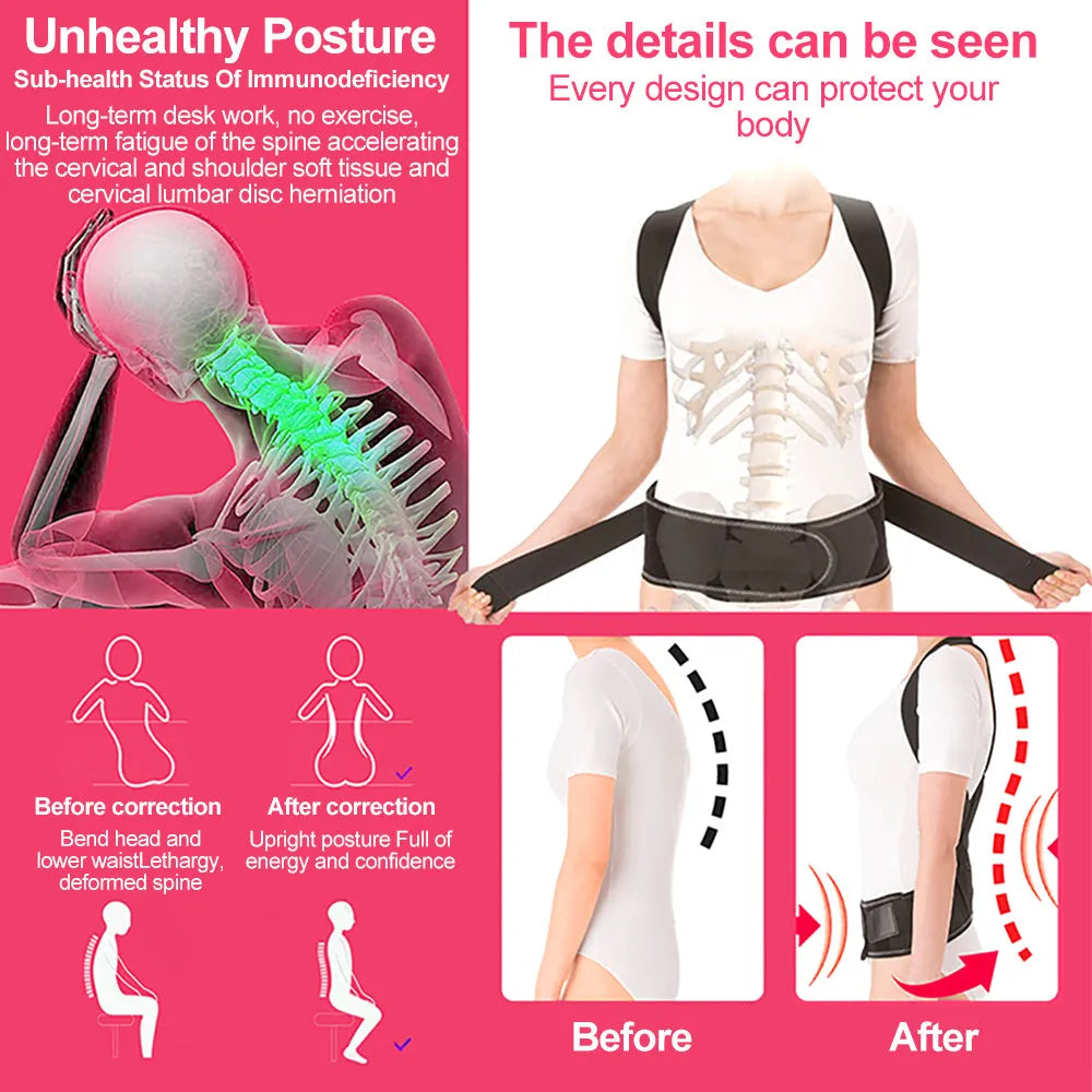 POSTURE CORRECTOR