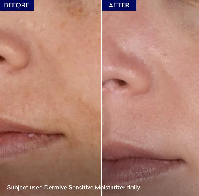 Dermive Sensitive Moisturizer